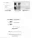 Fig. 10 - MicroRNA-200 based approaches for modulating bone formation inhibition and bone regeneration