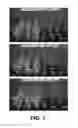 Fig. 02 - Methods and Compositions for Weed Control Using EPSPS Polynucleotides