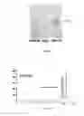 Fig. 04 - Genetically-engineered mycobacterium strain and a use thereof in the preparation of steroidal compounds