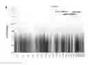 Fig. 01 - POLYMORPHISMS FOR PREDICTING TREATMENT RESPONSE TO ANTIPSYCHOTIC DRUGS AND IDENFYING NEW DRUG TARGETS