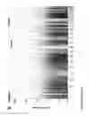 Fig. 03 - POLYMORPHISMS FOR PREDICTING TREATMENT RESPONSE TO ANTIPSYCHOTIC DRUGS AND IDENFYING NEW DRUG TARGETS