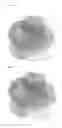Fig. 05 - Compositions and methods for detecting predisposition to cardiovascular disease