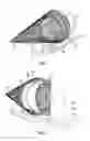 Fig. 02 - Hydroelectric/hydrokinetic turbine and methods for making and using same