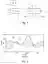 Fig. 02 - Method and apparatus for vibration compensation in a piston compressor