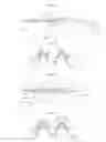 Fig. 04 - METHOD FOR SPLINING WHEEL BEARING