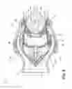 Fig. 09 - Low engagement force fluid coupling