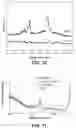 Fig. 06 - Rapid culture free pathogen detection via optical spectroscopy