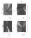 Fig. 04 - Compensating for access point orientation errors with respect to a predefined area orientation