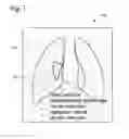 Fig. 02 - Display device for displaying a marked image field