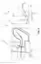 Fig. 07 - SYSTEM AND METHOD FOR ASSESSING OUTFLOW TRACT OBSTRUCTION OF A HEART OF A SUBJECT