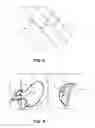 Fig. 08 - SYSTEM AND METHOD FOR ASSESSING OUTFLOW TRACT OBSTRUCTION OF A HEART OF A SUBJECT