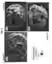 Fig. 06 - AMORPHOUS PROTEIN EXTRUDATES