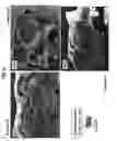 Fig. 07 - AMORPHOUS PROTEIN EXTRUDATES