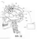 Fig. 15 - ULTRASOUND MODULATING OPTICAL TOMOGRAPHY USING REDUCED LASER PULSE DURATION