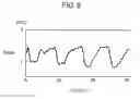 Fig. 07 - RESPIRATORY STATE ESTIMATION APPARATUS, RESPIRATORY STATE ESTIMATION METHOD, AND PROGRAM RECORDING MEDIUM