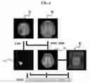 Fig. 03 - System and method for estimating acute cerebral infarction onset time