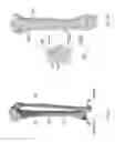 Fig. 02 - Distal tibial plating system
