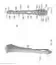 Fig. 08 - Distal tibial plating system