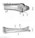 Fig. 13 - Distal tibial plating system