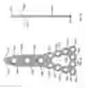 Fig. 19 - Distal tibial plating system