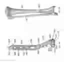 Fig. 20 - Distal tibial plating system