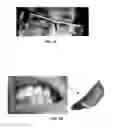 Fig. 04 - Augmented reality enhancements for dental practitioners