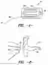 Fig. 02 - EAR INSERT FOR RELIEF OF TMJ DISCOMFORT AND HEADACHES