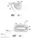Fig. 04 - EAR INSERT FOR RELIEF OF TMJ DISCOMFORT AND HEADACHES