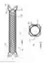 Fig. 02 - Stent and stent delivery device
