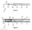 Fig. 06 - Stent and stent delivery device