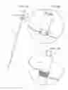 Fig. 06 - Radially adjustable stent graft delivery system and method of use