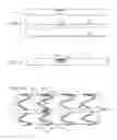 Fig. 07 - Radially adjustable stent graft delivery system and method of use