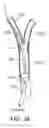 Fig. 07 - Systems and methods for treating a carotid artery
