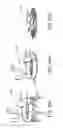 Fig. 85 - Systems and methods for treating a carotid artery
