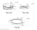 Fig. 89 - Systems and methods for treating a carotid artery