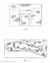 Fig. 35 - Methods and devices for reducing pregnancy-related and post-natal lower back pain
