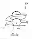 Fig. 02 - Oral appliance