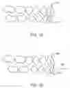 Fig. 02 - Systems and methods for positioning a patient's mandible in response to sleep apnea status