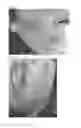 Fig. 02 - Use of an active substance in the treatment of melasma
