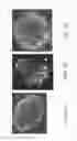 Fig. 07 - Kidney production method