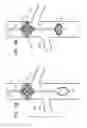 Fig. 09 - Blood pumps