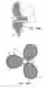 Fig. 32 - Blood pumps