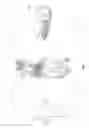 Fig. 02 - Systems and methods for performing online extracorporeal photopheresis