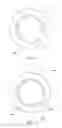 Fig. 07 - Insufflation retention device with balloon