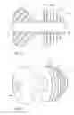 Fig. 35 - Insufflation retention device with balloon
