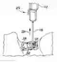 Fig. 01 - APPARATUS AND METHOD FOR FORMING AN OPENING IN PATIENT'S TISSUE
