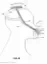 Fig. 09 - Respiratory pressure therapy system