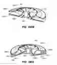 Fig. 64 - Respiratory pressure therapy system