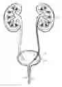 Fig. 01 - URETERAL GUIDEWIRE AND STENT