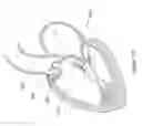 Fig. 131 - Inflatable medical devices